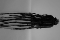 Scalp